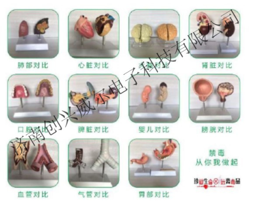 吸毒前后器官對比模型